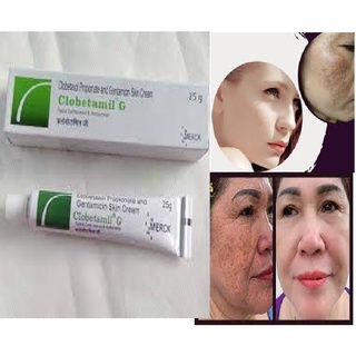 Sỉ 10 Tuýp 𝐭𝐫𝐢̣ nám, tàn nhang clobetamil G thái lan