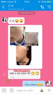 KEM NGHỆ NẾP ĐỎ