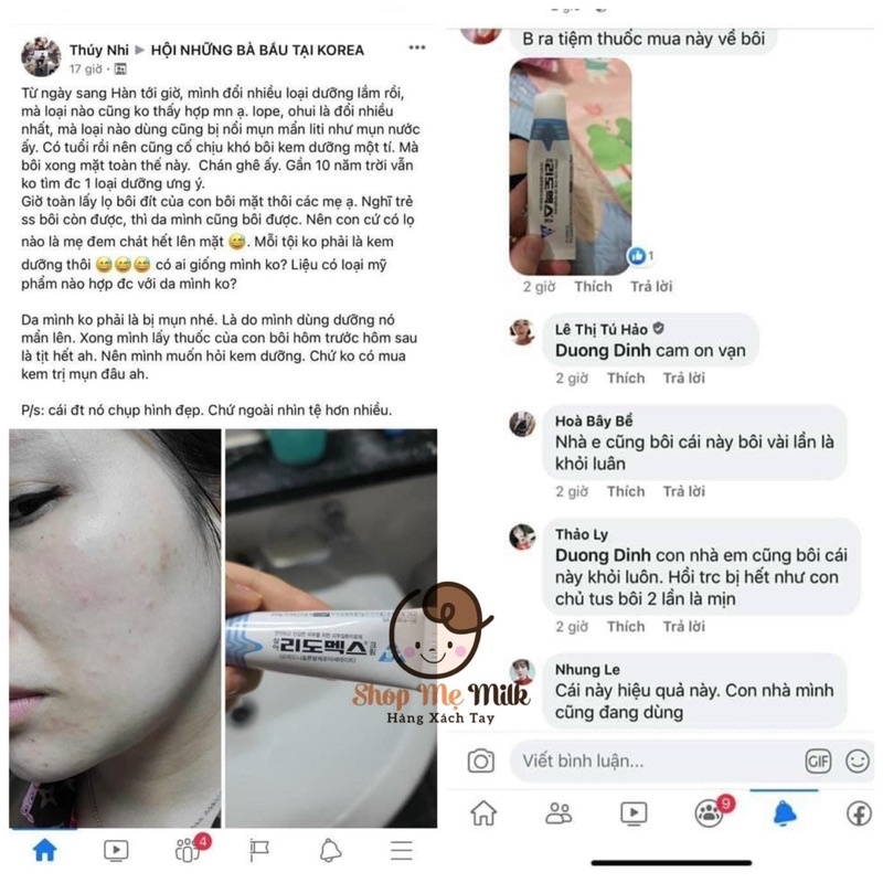 Kem Lidomex bôi da cho bé chàm, viêm da cơ địa của Hàn Quốc