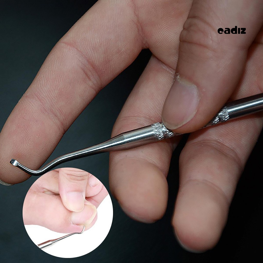 [Hàng mới về] Dụng cụ nâng móng chân/móng tay mọc ngược