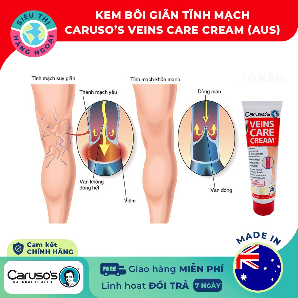 Kem bôi suy giãn tĩnh mạch Carusos Veins Care Cream 75g của Úc