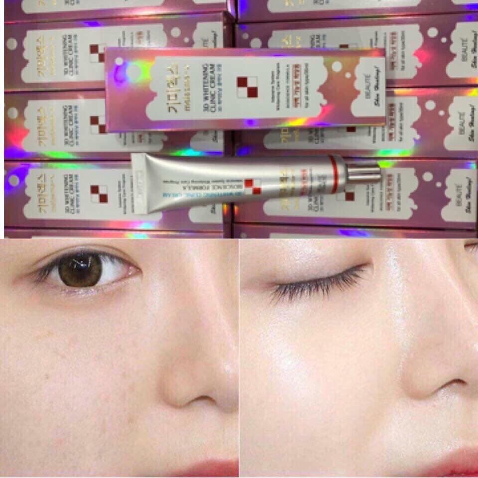 Kem Hỗ Trợ Giảm Nám, Tàn Nhang Và Dưỡng Trắng Da Melasma-X 3D Whitening Clinic Cream | BigBuy360 - bigbuy360.vn