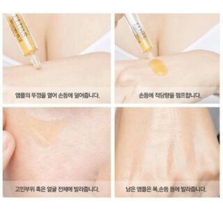 Set 4 ống serum tế bào gốc ELDAS EG tox program