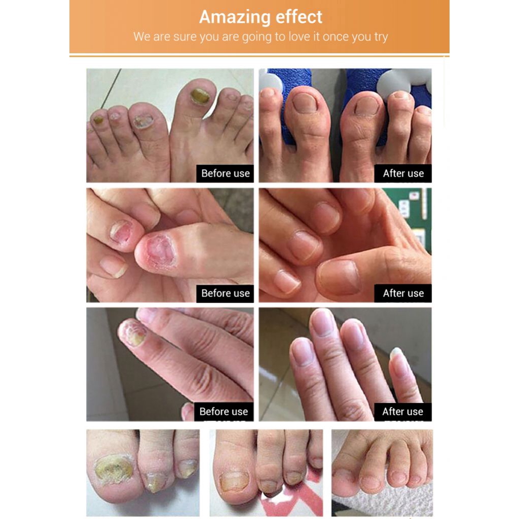 Tinh Chất Phục Hồi Móng Tay / Chân Lanbena Chiết Xuất Hoa Hướng Dương | BigBuy360 - bigbuy360.vn