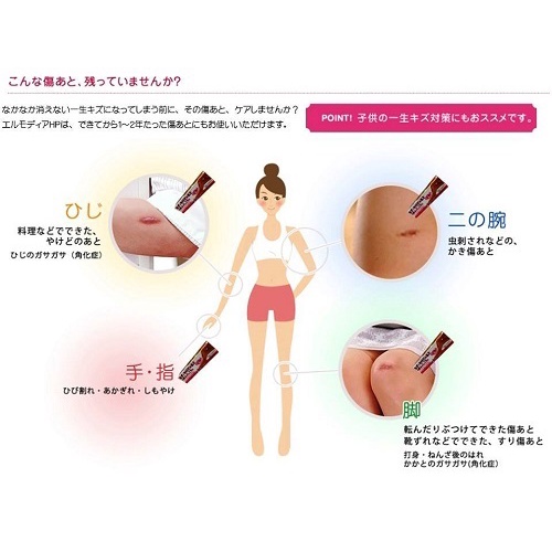 GEL BÔI MỜ SẸO EX KOBAYASHI 15GR - HÀNG NHẬT NỘI ĐỊA