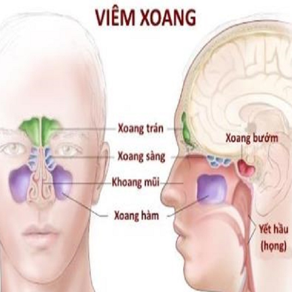 [A CHÈN] [GIA TRUYỀN] Dược phẩm xịt viem xoang viem mui di ung