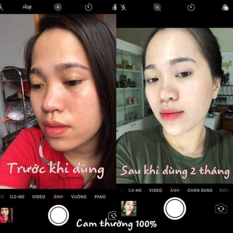 KEM FACE LƯỜI THƯỢNG HẠNG QUEENIE SKIN  Cấp Ẩm - Căng Mịn - Sáng Bóng Mới