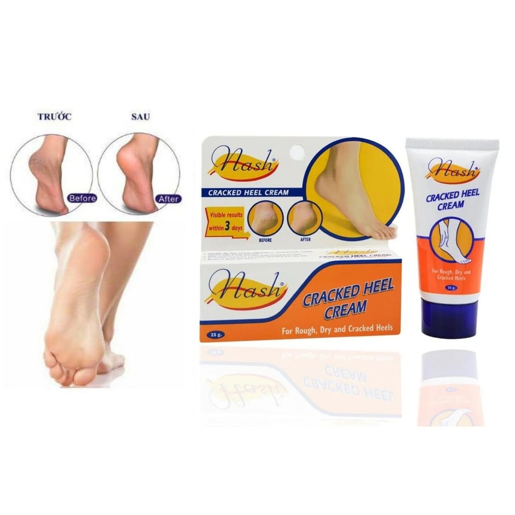 Kem Làm Mềm Gót Chân Nứt Nash - Nash Cracked Heel Cream 25gr (NA2016)