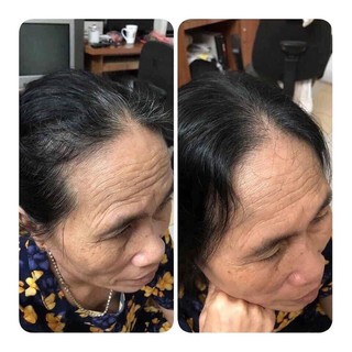 DẦU GỘI THẢO DƯỢC NHUỘM ĐEN TÓC LICH 5