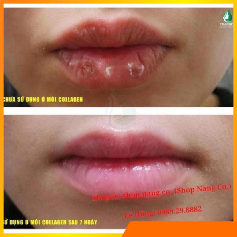 SON Ủ MÔI SHI - MỀN MÔI -DƯỠNG MÔI - HỒNG MÔI - TRỊ THÂM MÔI V V V . | BigBuy360 - bigbuy360.vn