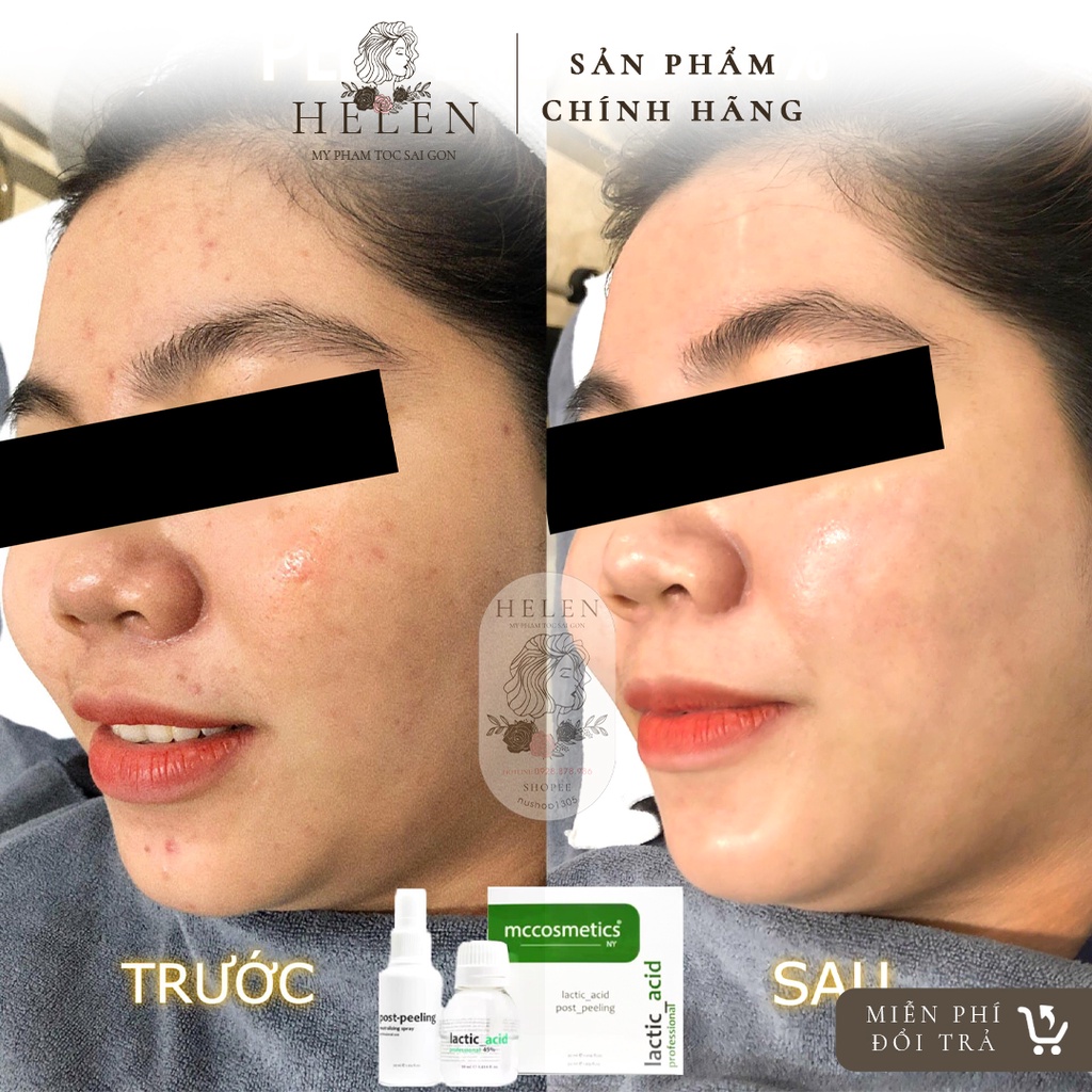 Peel LACTIC MCCM MCCOSMETIC - Tái tạo làn da giúp trẻ hóa, se khít lỗ chân lông, cho làn da mịn màng căng bóng