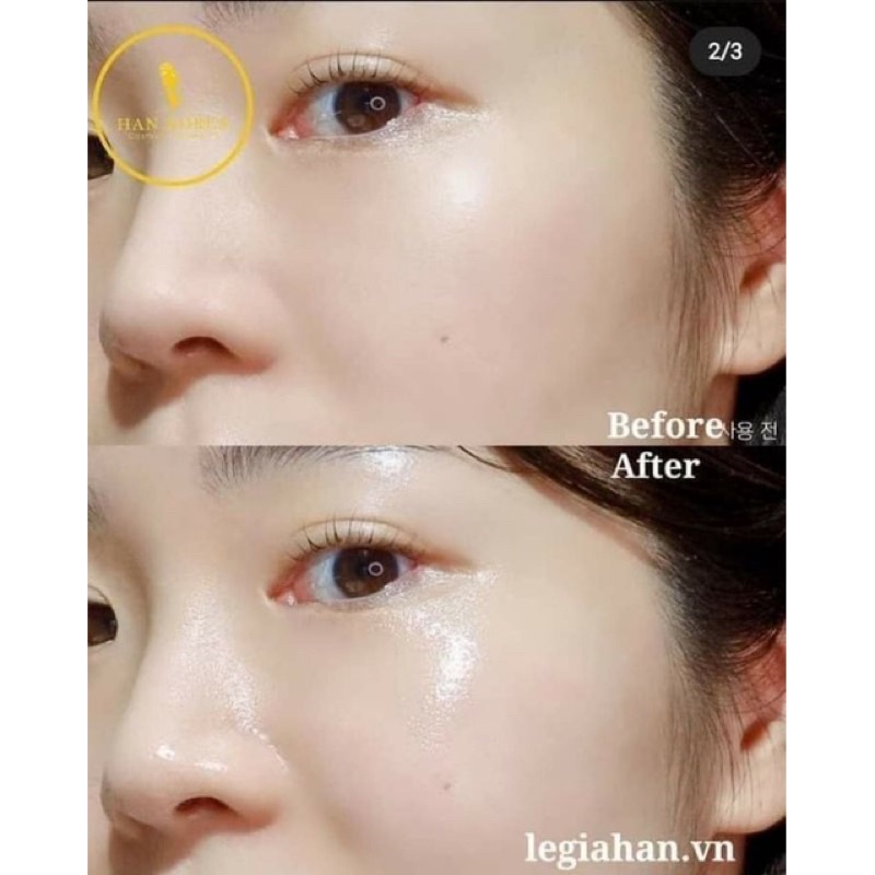 Kem Dưỡng Trẻ Hoá Da Retinol X5 Skinpaster