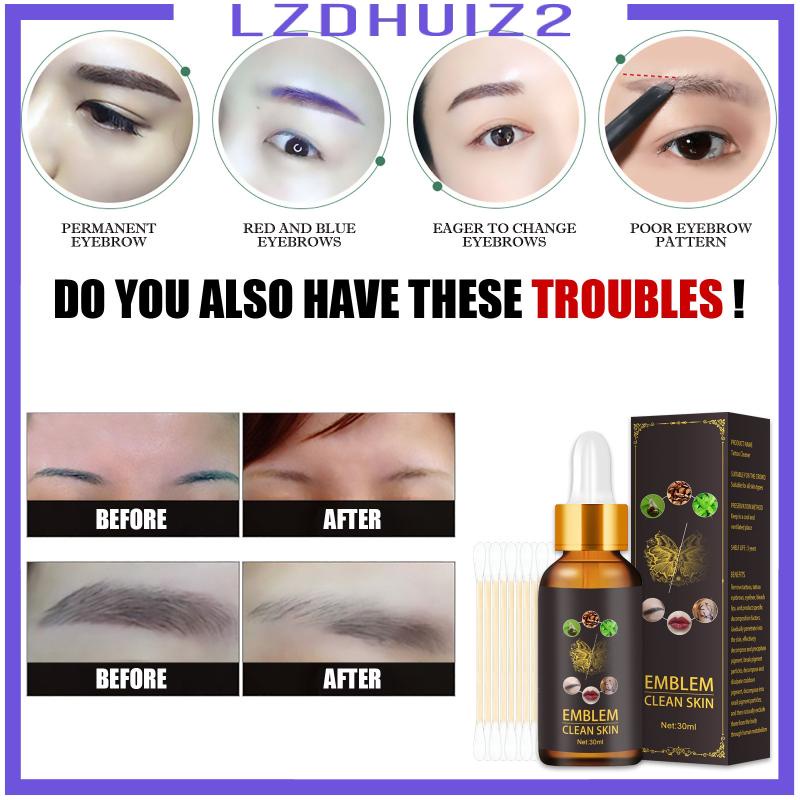 Dung Dịch Loại Bỏ Hình Xăm Vĩnh Viễn An Toàn 30ml