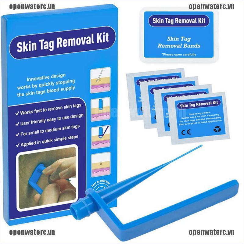 OPC Micro Tag Band Skin Tag Remover Kit for Fast & Effective Skin Tag Removal