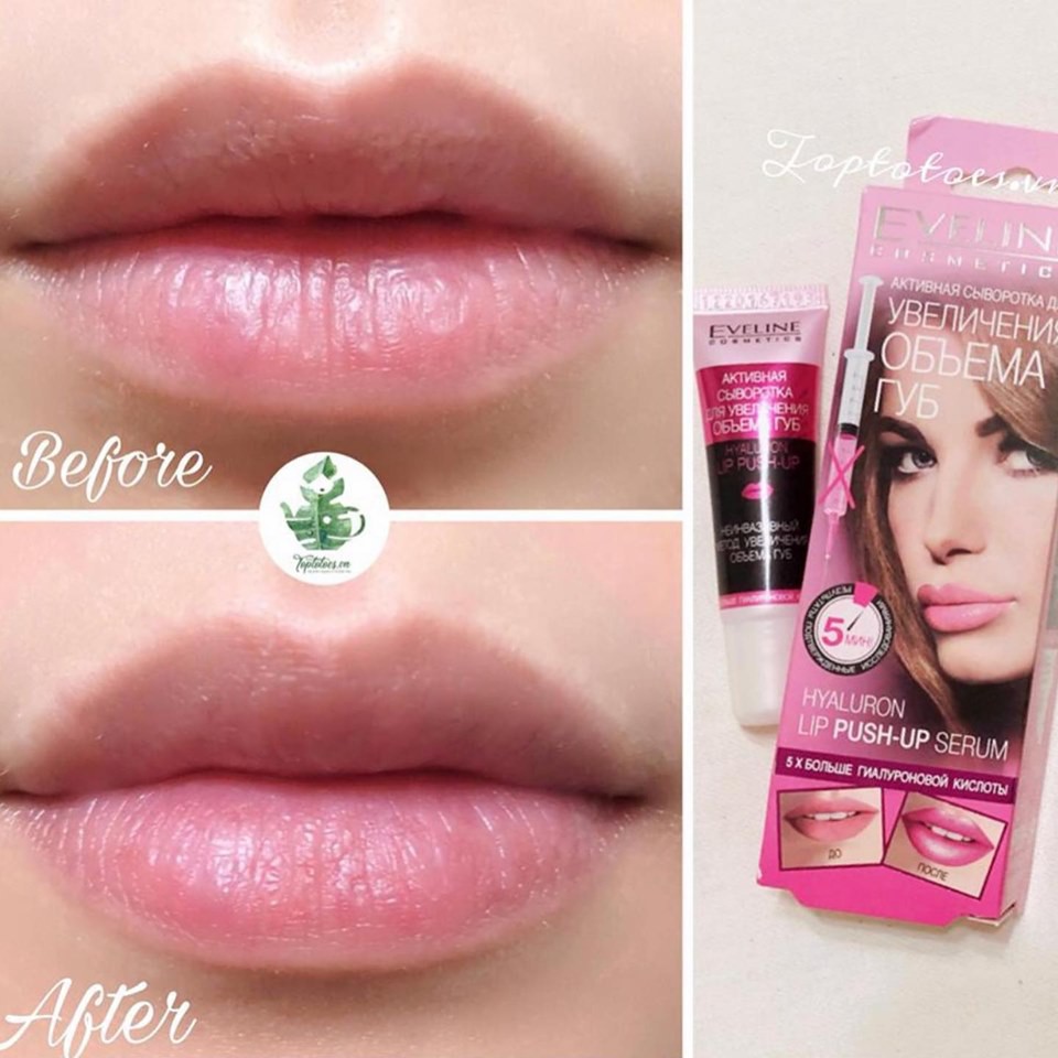 Serum dưỡng #căng #mọng và làm #hồng #môi Eveline Hyaluron Lip Push Up