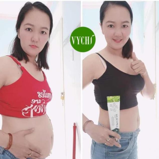 Kem tan mỡ bụng LIPOSLIM GEL kem giảm mỡ bụng dùng cho cả mẹ bầu sau sinh NAG