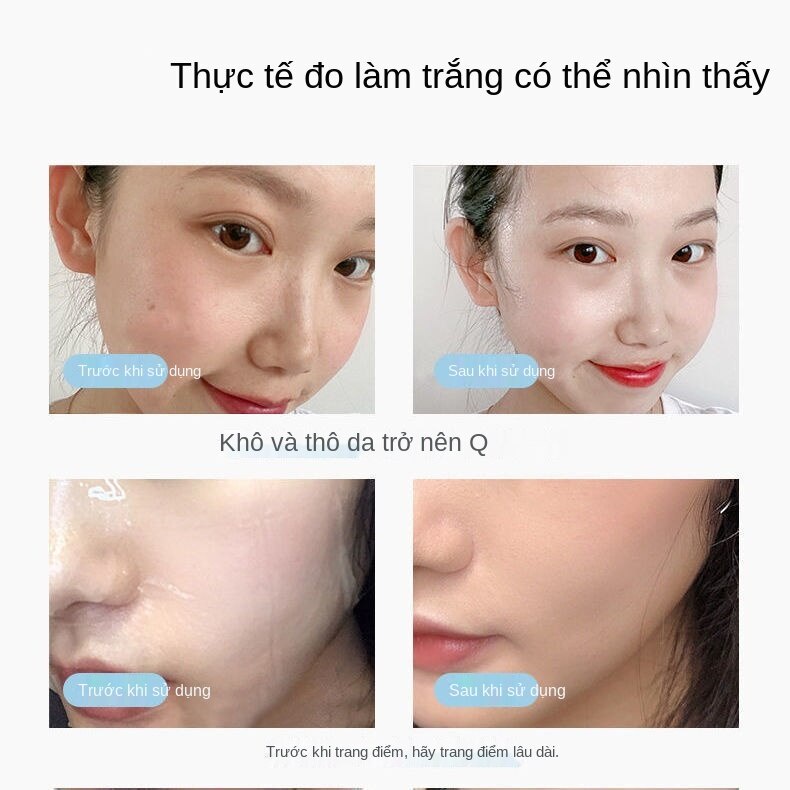 [Tốt nhất nên dùng] Mặt nạ dưỡng ẩm, làm trắng da, thu nhỏ lỗ chân lông, làm sạch và dưỡng ẩm