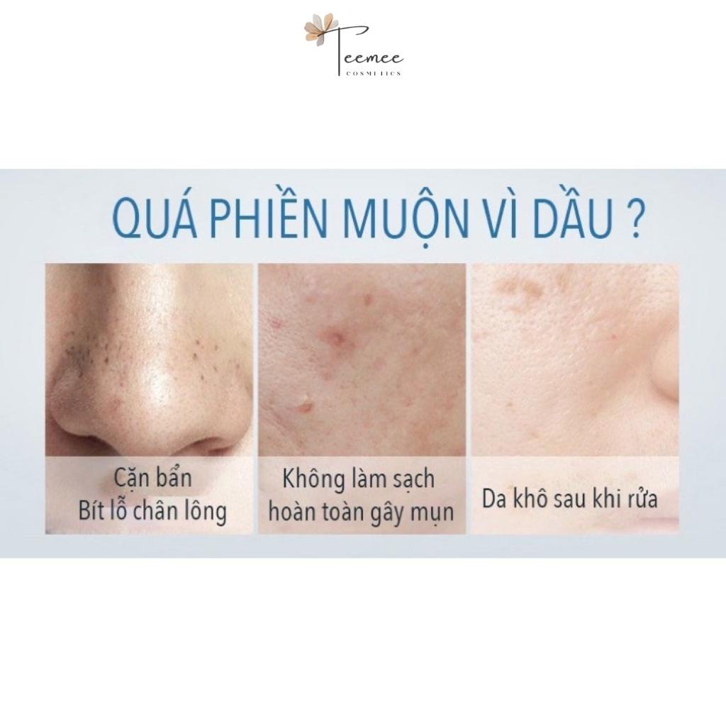 Sữa rửa mặt dành cho da dầu, sữa sửa mặt tạo bọt Lucenbase giảm mụn, làm sạch sâu 150ml | BigBuy360 - bigbuy360.vn