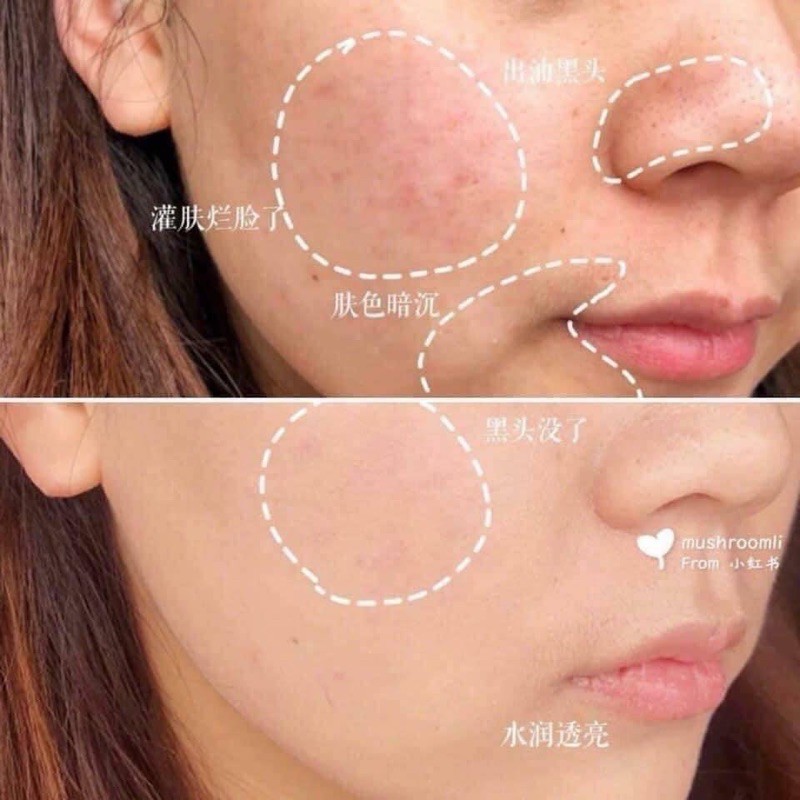 [Link BHA] Tinh chất giảm thâm làm sáng da Kielh’s Clearly Corrective Dark Spot Solution