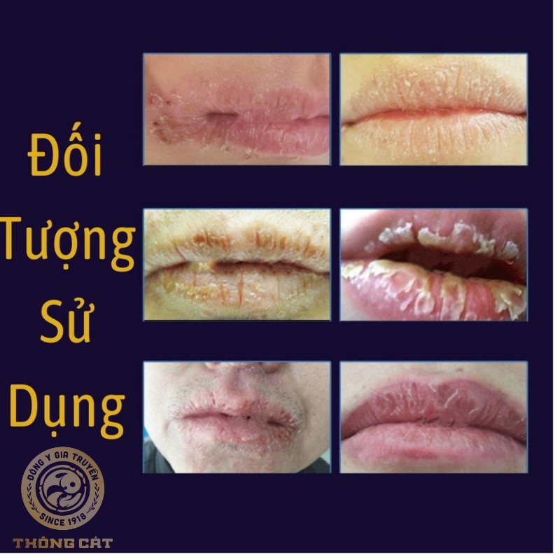 Son dưỡng môi không màu thảo mộc hữu cơ_Dưỡng ẩm hồng môi, hết nẻ môi, khô môi, mềm mịn Đông y gia truyền Thông Cát