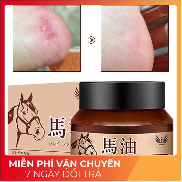 Kem Dầu Ngựa chuyên Nứt Gót Chân, Nẻ Da Tay