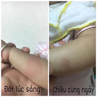 Lăn Muỗi Muhi Nhật