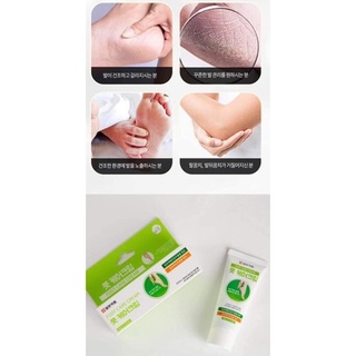 kem bôi nứt gót chân Hàn quốc