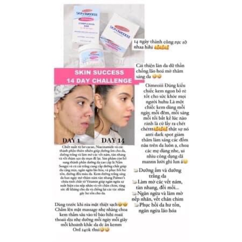 Bill US - Kem dưỡng Niacinamide làm trắng da, mờ thâm Palmers