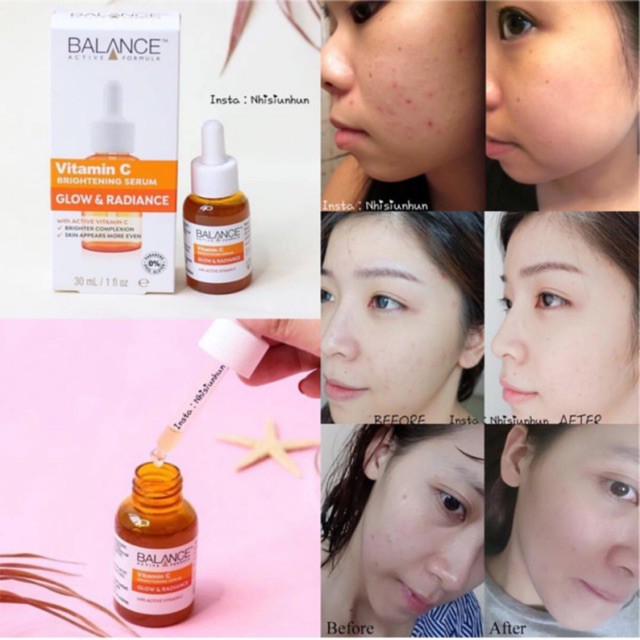 Serum Balance [Hot New-Hàng Auth] Tinh Chất mờ thâm sau mụn Vitamin C Balance Active Formula 30ml