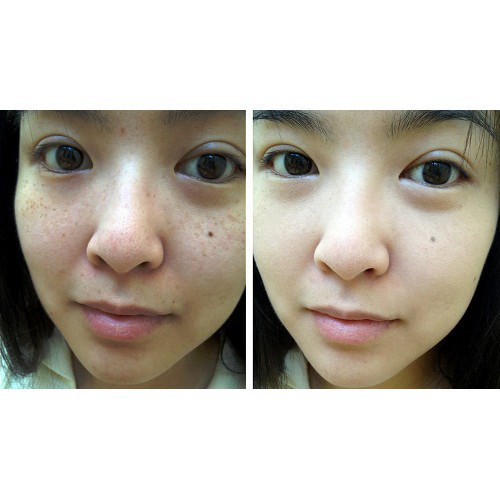 Sữa Rửa Mặt Med Xanh Giảm Mụn Dành Cho Da Dầu 200ML