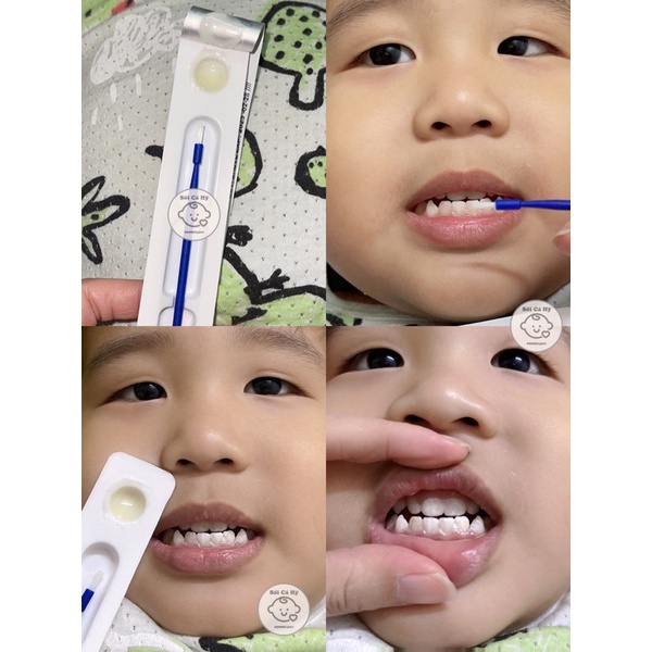 Kem bôi chống sâu răng Mỹ