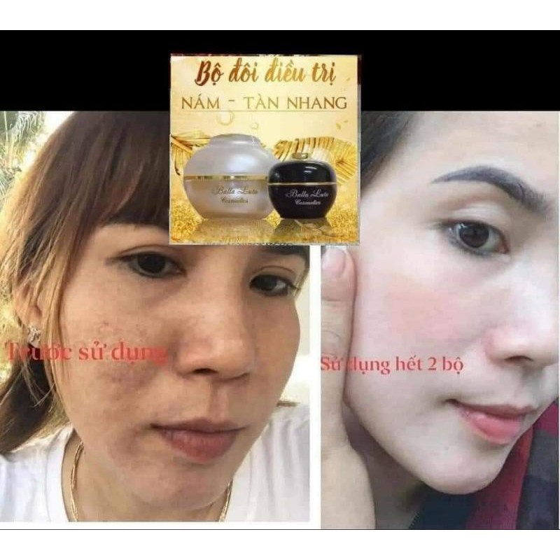 Cao Nám Balla Luta Lớn 30gr Chính Hãng