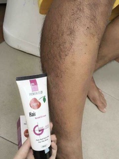 Kem Tẩy Lông