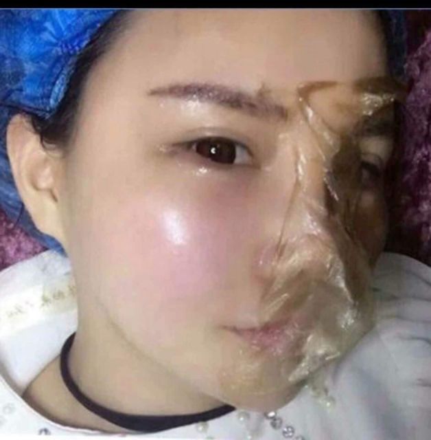 MẶT NẠ MÀNG TẾ BÀO GỐC GOGO