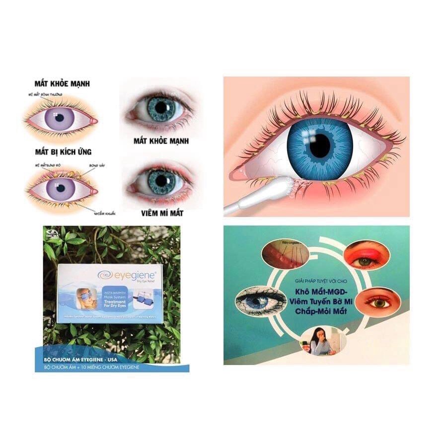 MIẾNG CHƯỜM ẤM MẮT CHƯỜM ẤM EYEGIENE - USA, GÓI LẺ CHỈ MIẾNG