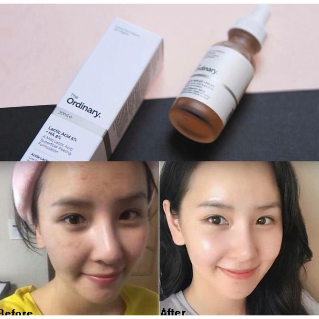 Serum Sáng Da Lactic Acid 5%+ HA - The Ordinary
