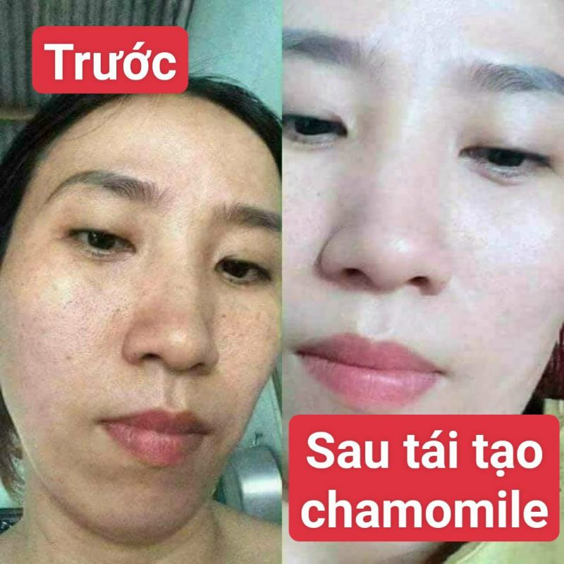 Kem tái tạo chamomile hồng sâm