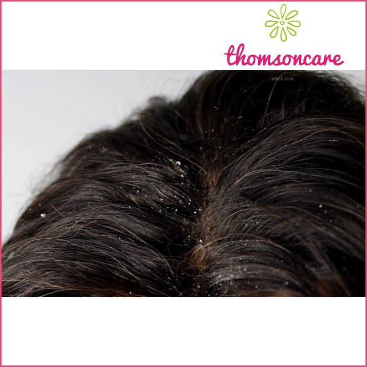 Dầu gội ngăn ngừa gầu Fibonacci chai 100ml - sạch gàu, hết ngứa từ ketoconazole | BigBuy360 - bigbuy360.vn