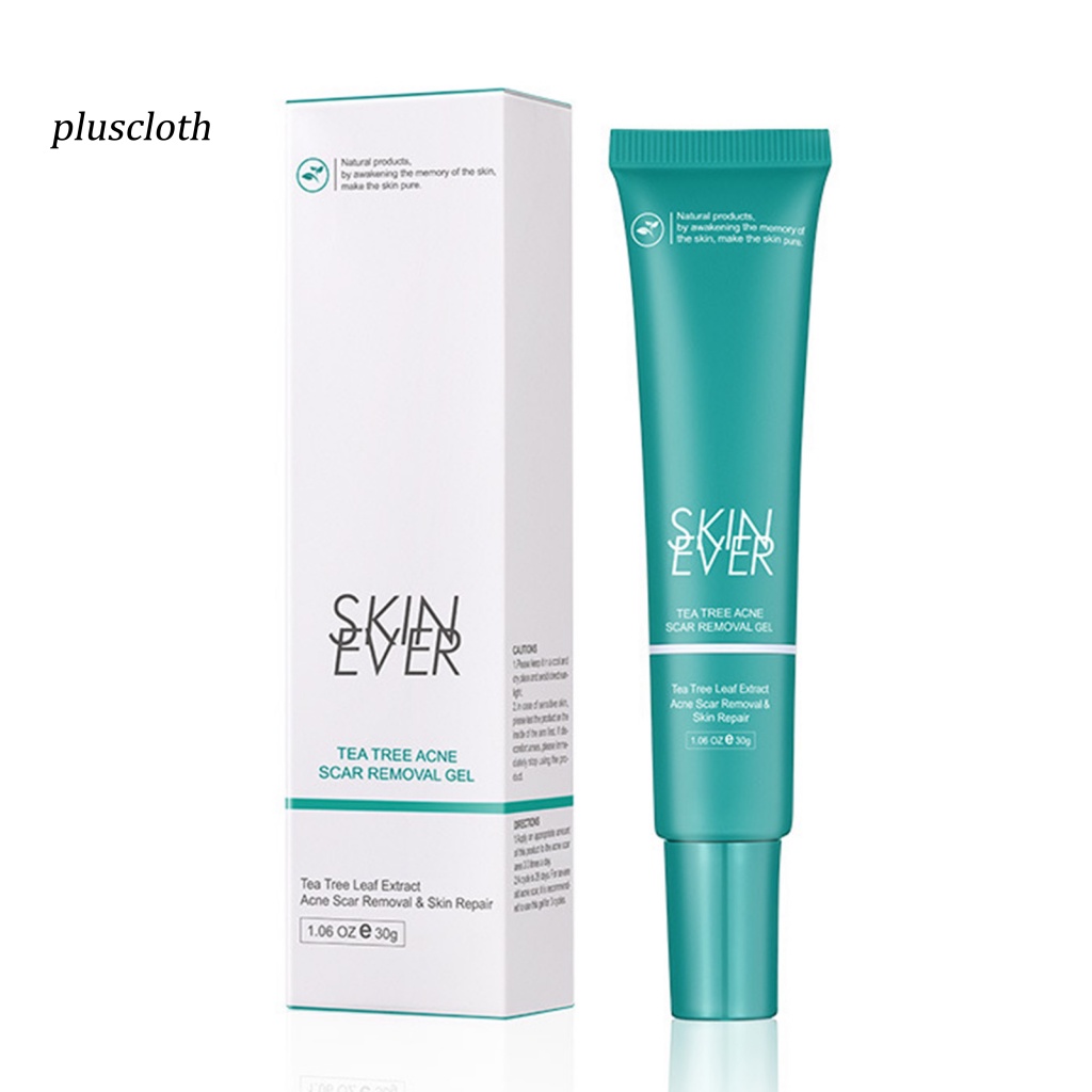 Tuýp Kem Hỗ trợ giảm mụn Trứng Cá Chăm Sóc Da Mặt 30g