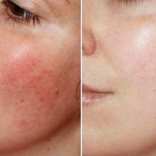 Tinh chất serum phục hồi b5 oxy gen