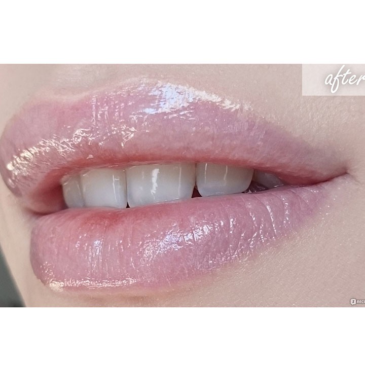 Tẩy da chết môi Alvedre Lip Crub hàng Đức Chuẩn | BigBuy360 - bigbuy360.vn