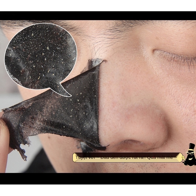 [Hàng mới về] Mặt Nạ Bùn Khoáng Lột Mụn Đầu Đen Cho Vùng Mũi