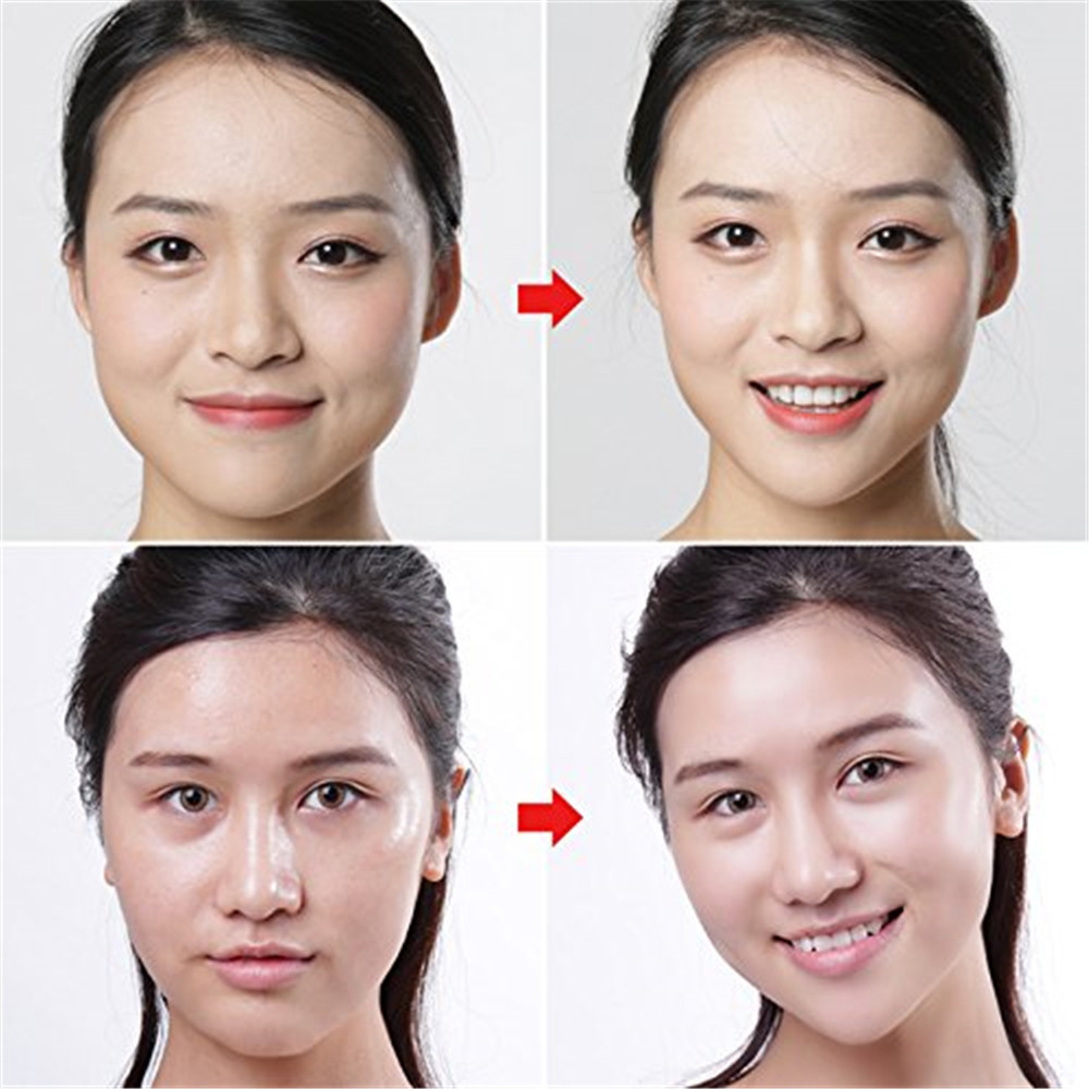 Bộ 100 Miếng Dán Nâng Cơ Mặt Trong Suốt