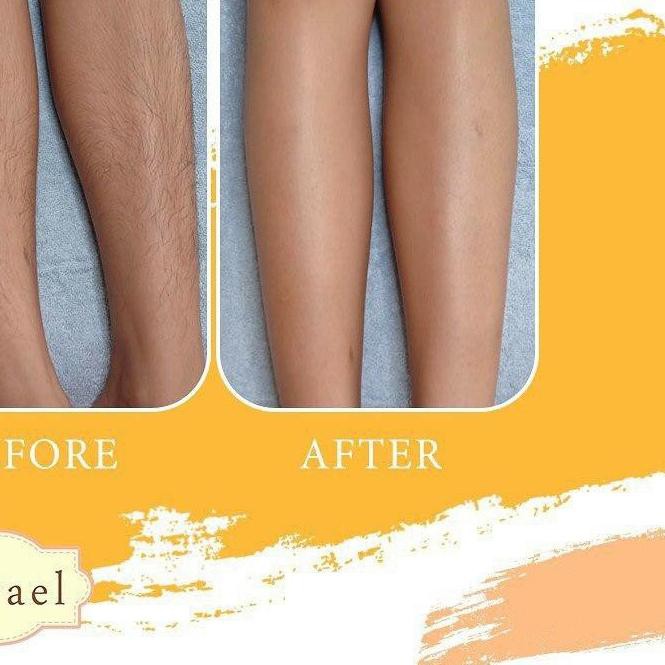 (Hàng Mới Về) Bộ Dụng Cụ Tẩy Lông Mirael Tiện Dụng | BigBuy360 - bigbuy360.vn