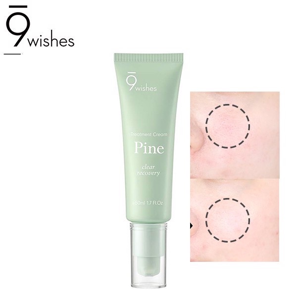 [Tem Chính Hãng] Kem dưỡng phục hồi 9 Wishes Pine Treatment Cream Hàn Quốc 50ml