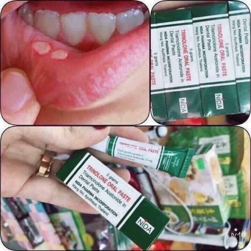 Kem Bôi Nhiệt Miệng Thái Lan