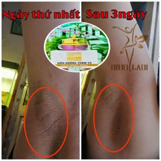 BIHO LADI SIÊU DƯỠNG THÂM