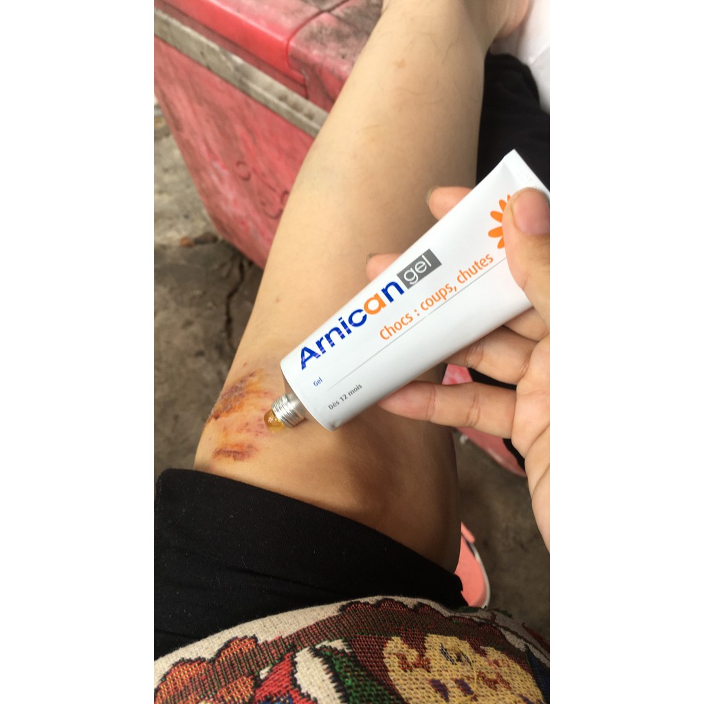 Kem Tan Máu Bầm Arnican Gel Nội Địa Pháp - 50g