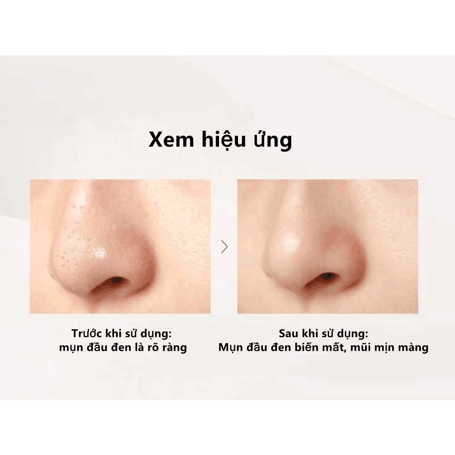 Miếng dán lột mụn đầu đen mũi RNW se khít lỗ chân lông hiệu quả