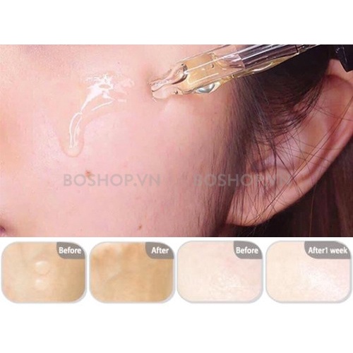 Tinh Chất Mờ Thâm Nám Sáng Da DongSung Rannce Serum 45ml